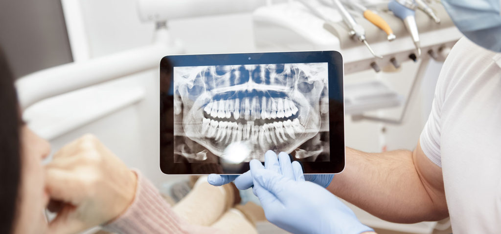 digital dental x ray
