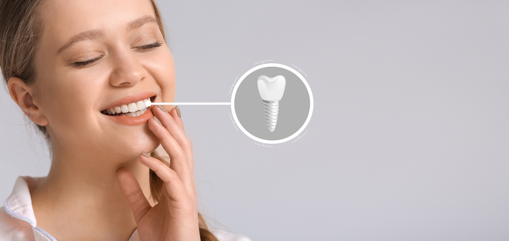 dental implant healing stages